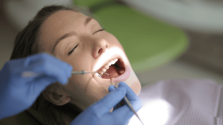 Dental crowns vs fillings