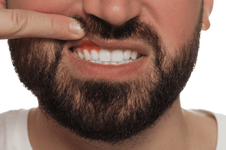 Man with gum pain