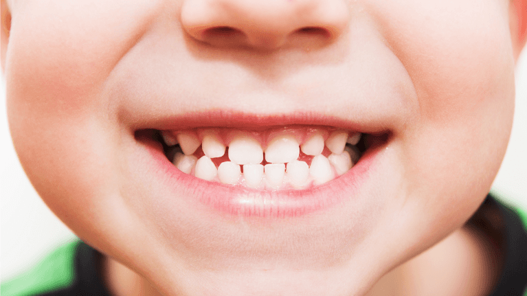 Kids teeth