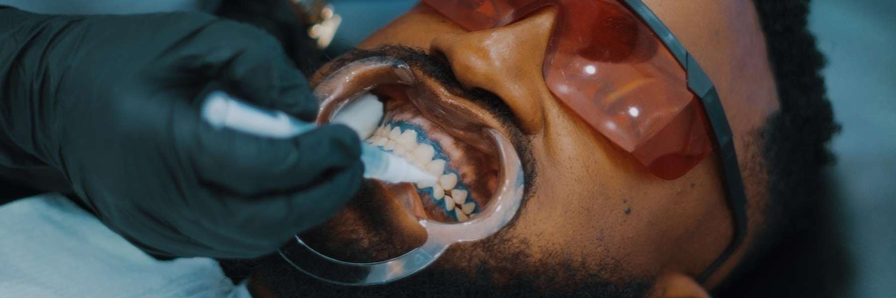 Professional Teeth Whitening | Dentist